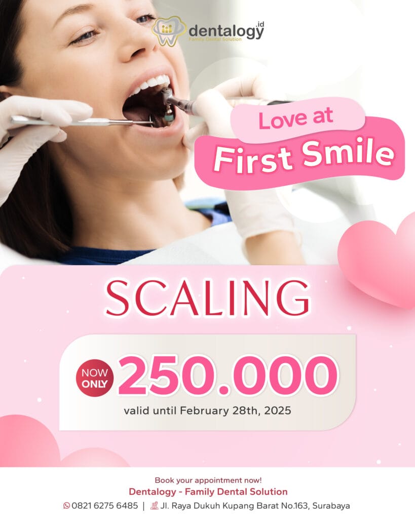 Love at First Smile: Scaling