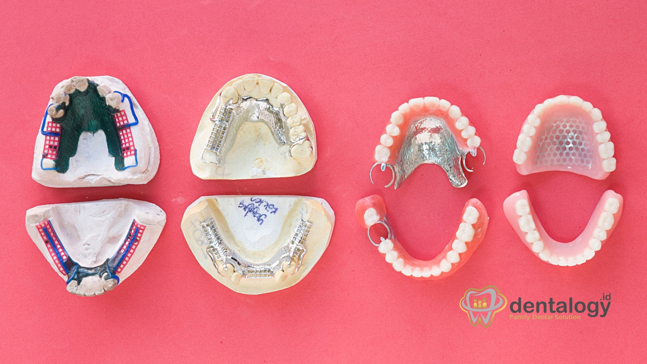 Perbedaan Ortodonti dan Prostodontik