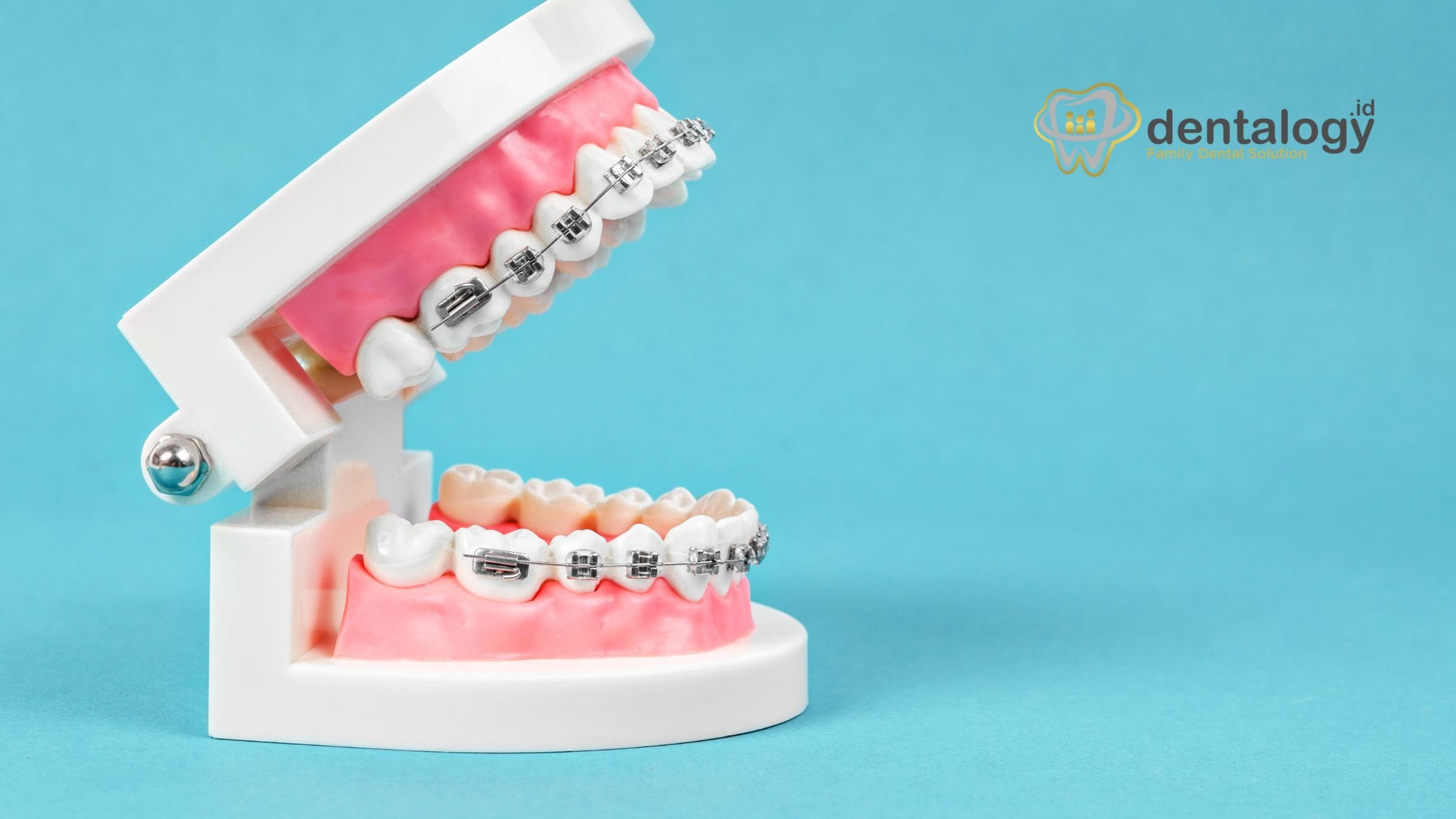 gigi tidak bisa pasang behel