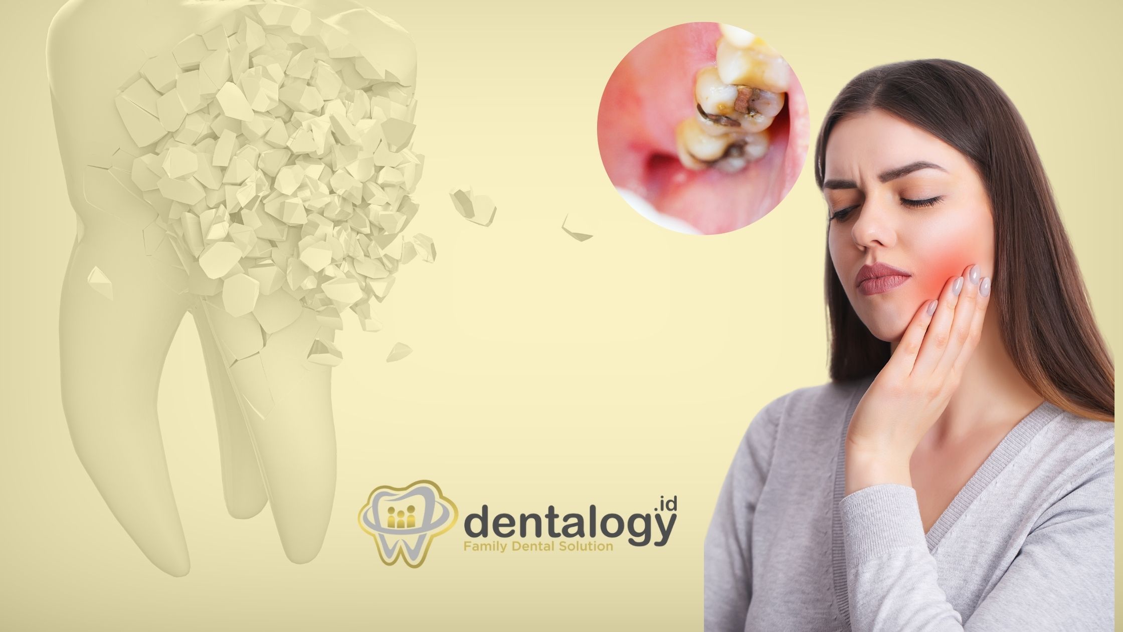 sakit gigi setelah tambal