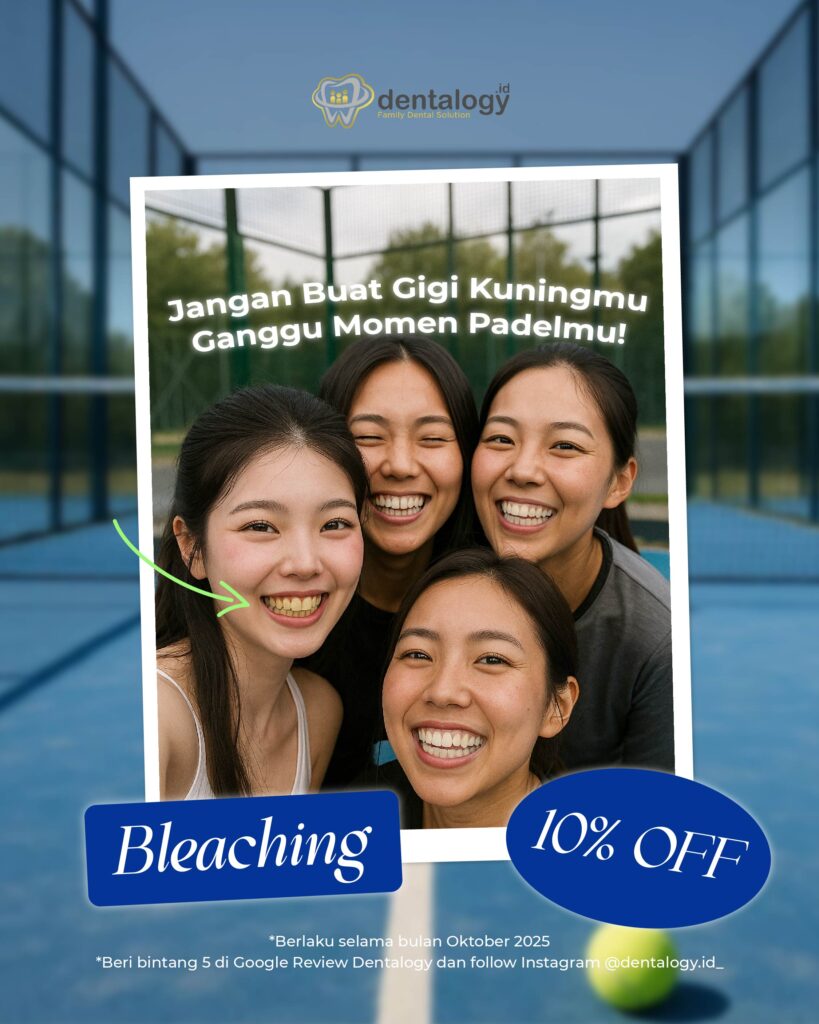 Promo Bleaching Gigi Oktober 2025 Dentalogy
