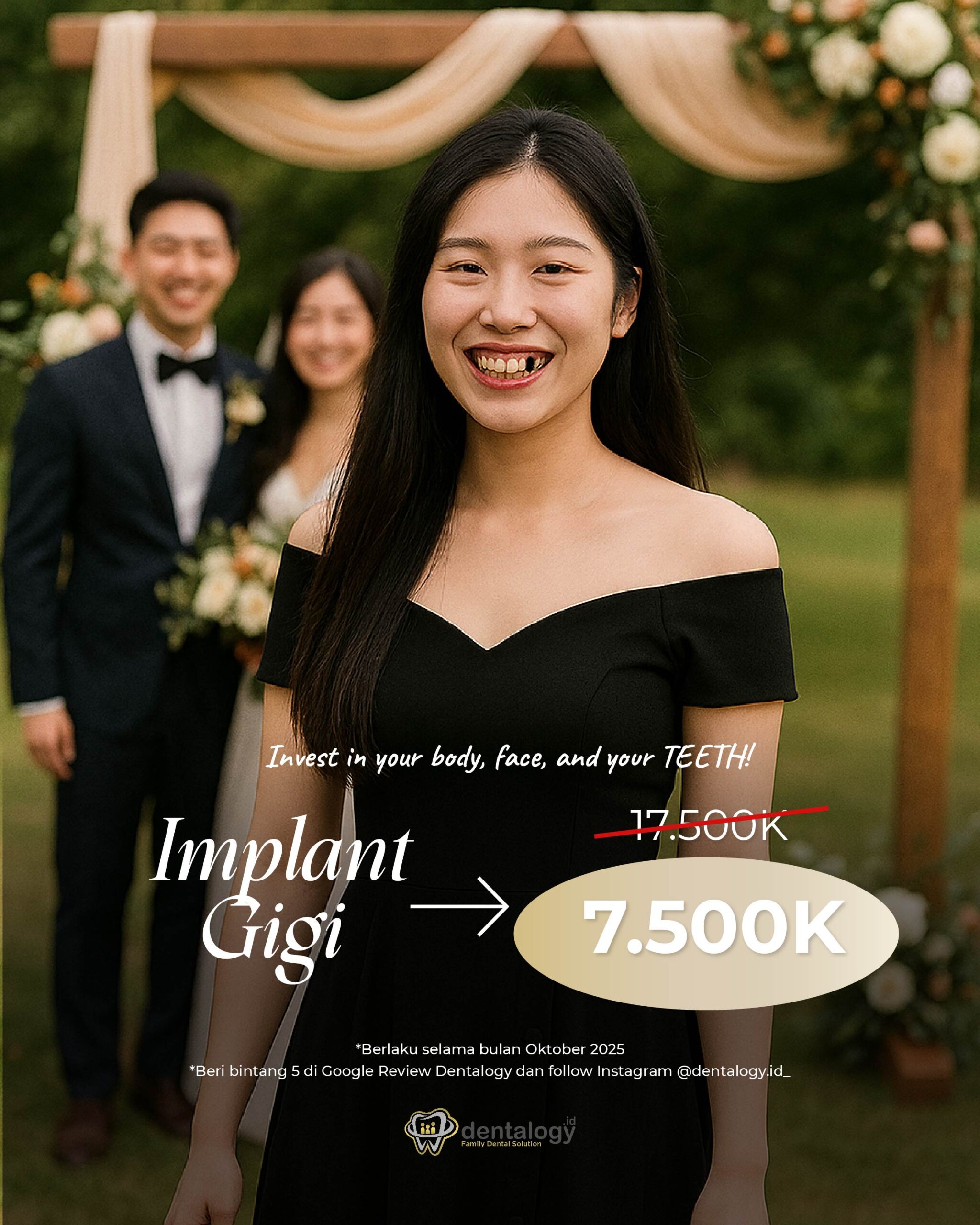 Promo Implant Gigi Oktober 2025 Dentalogy
