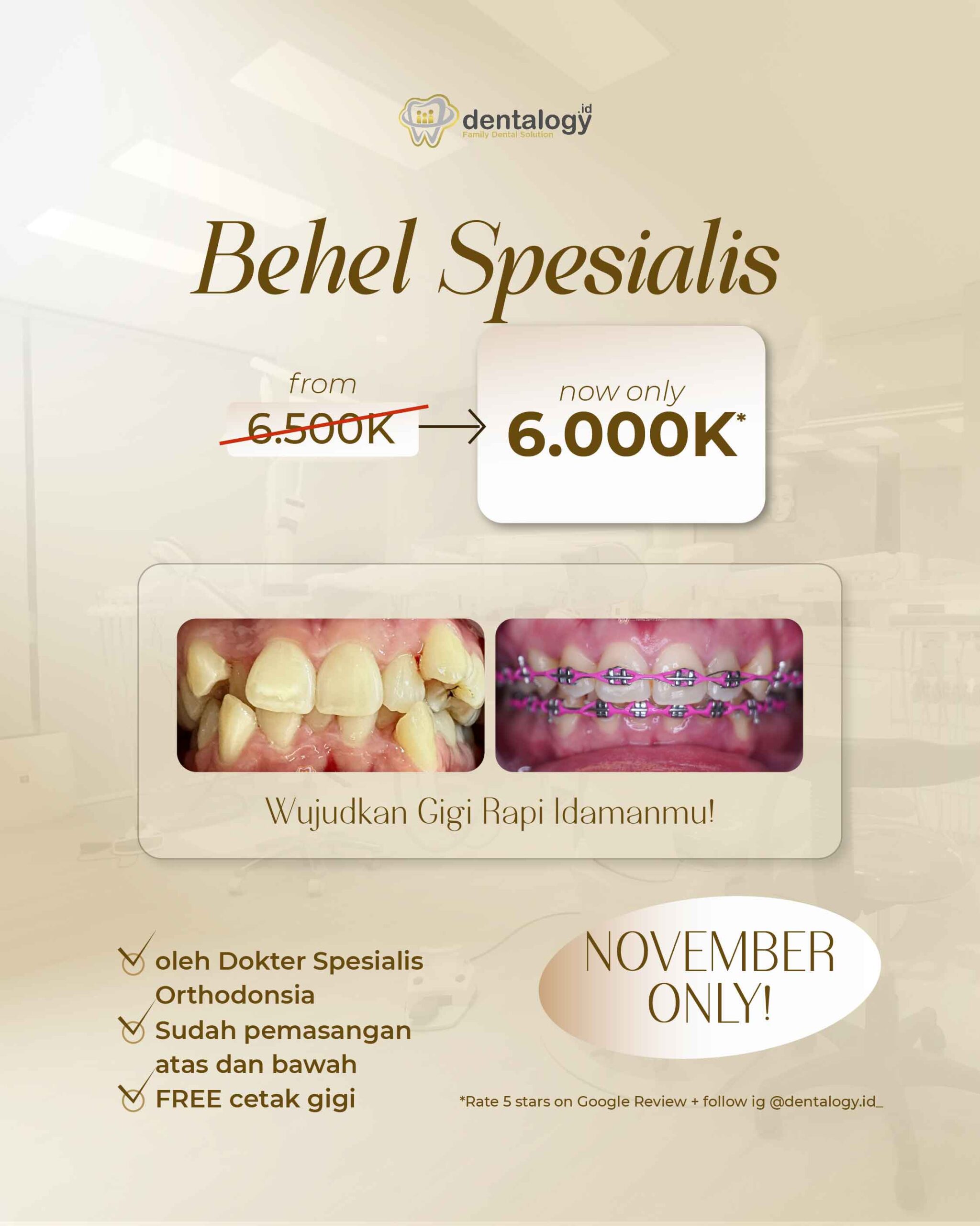 Wujudkan Gigi Rapi Idamanmu