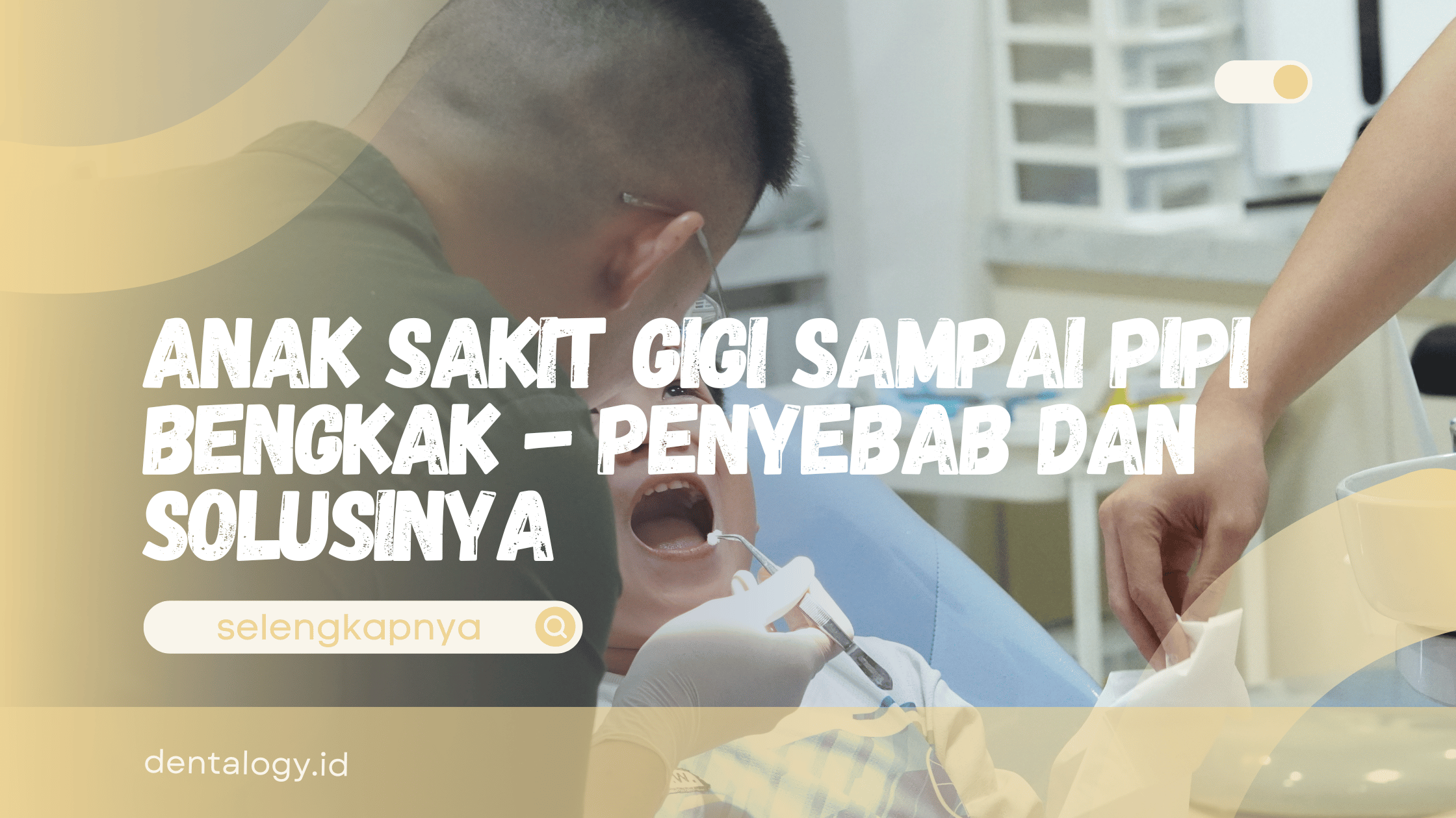 Anak Sakit Gigi Sampai Pipi Bengkak