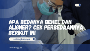 Apa Bedanya Behel dan Aligner