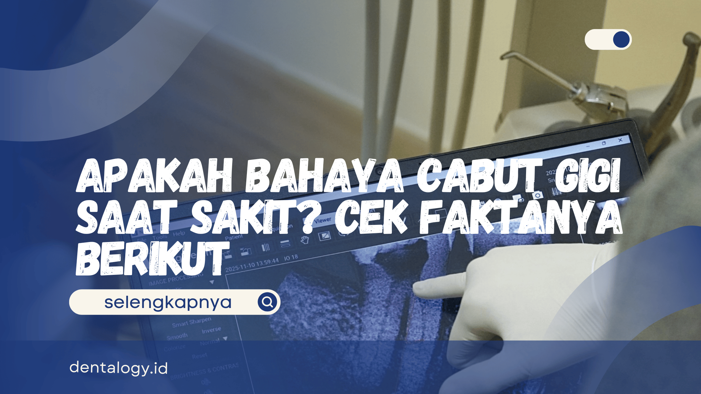 Apakah Bahaya Cabut Gigi Saat Sakit