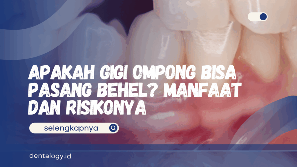 Apakah Gigi Ompong Bisa Pasang Behel