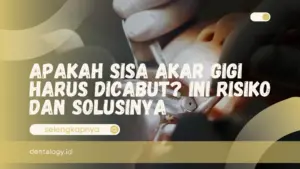 Apakah Sisa Akar Gigi Harus Dicabut