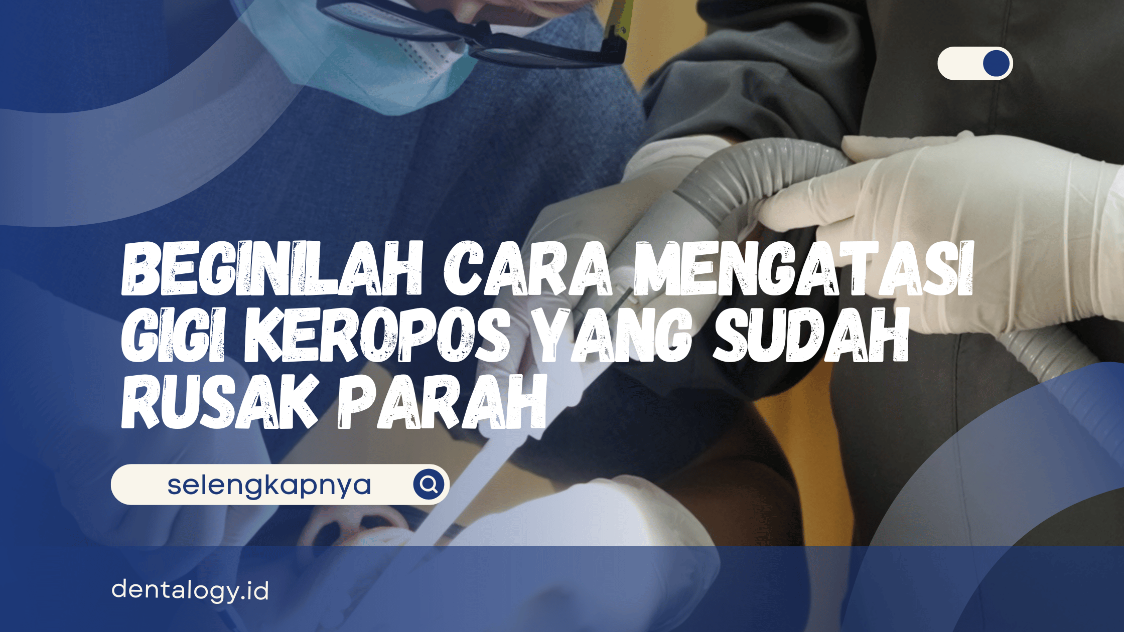 Cara Mengatasi Gigi Keropos