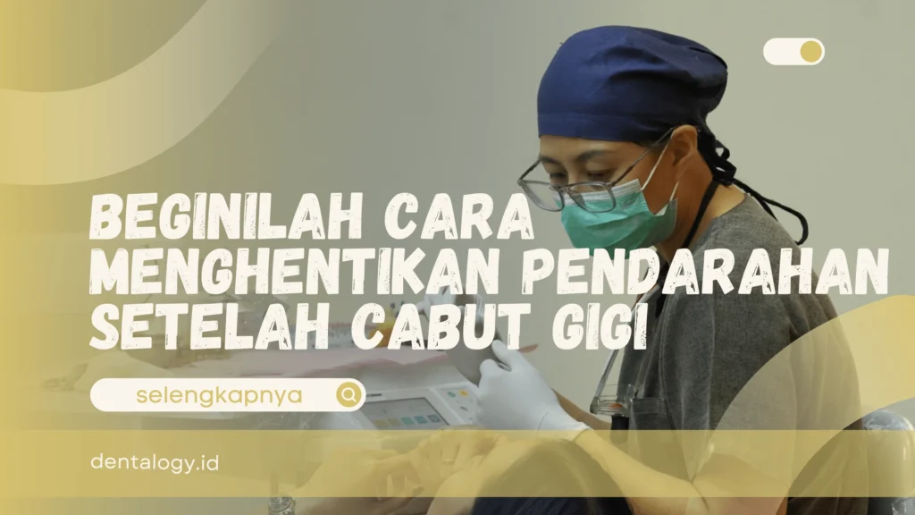 Cara Menghentikan pendarahan setelah cabut gigi