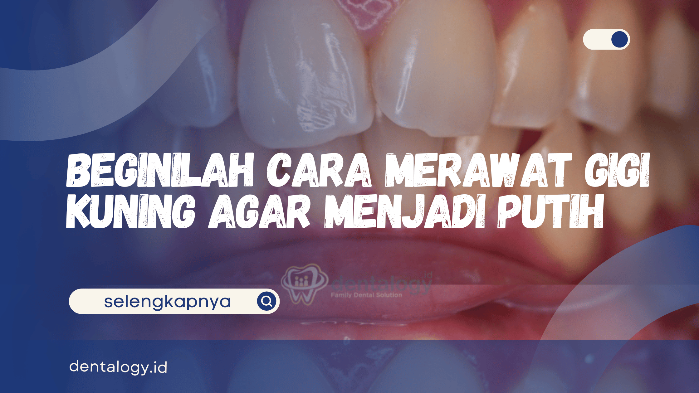 Cara Merawat Gigi Kuning Agar Menjadi Putih