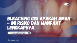 Bleaching Gigi Apakah Aman