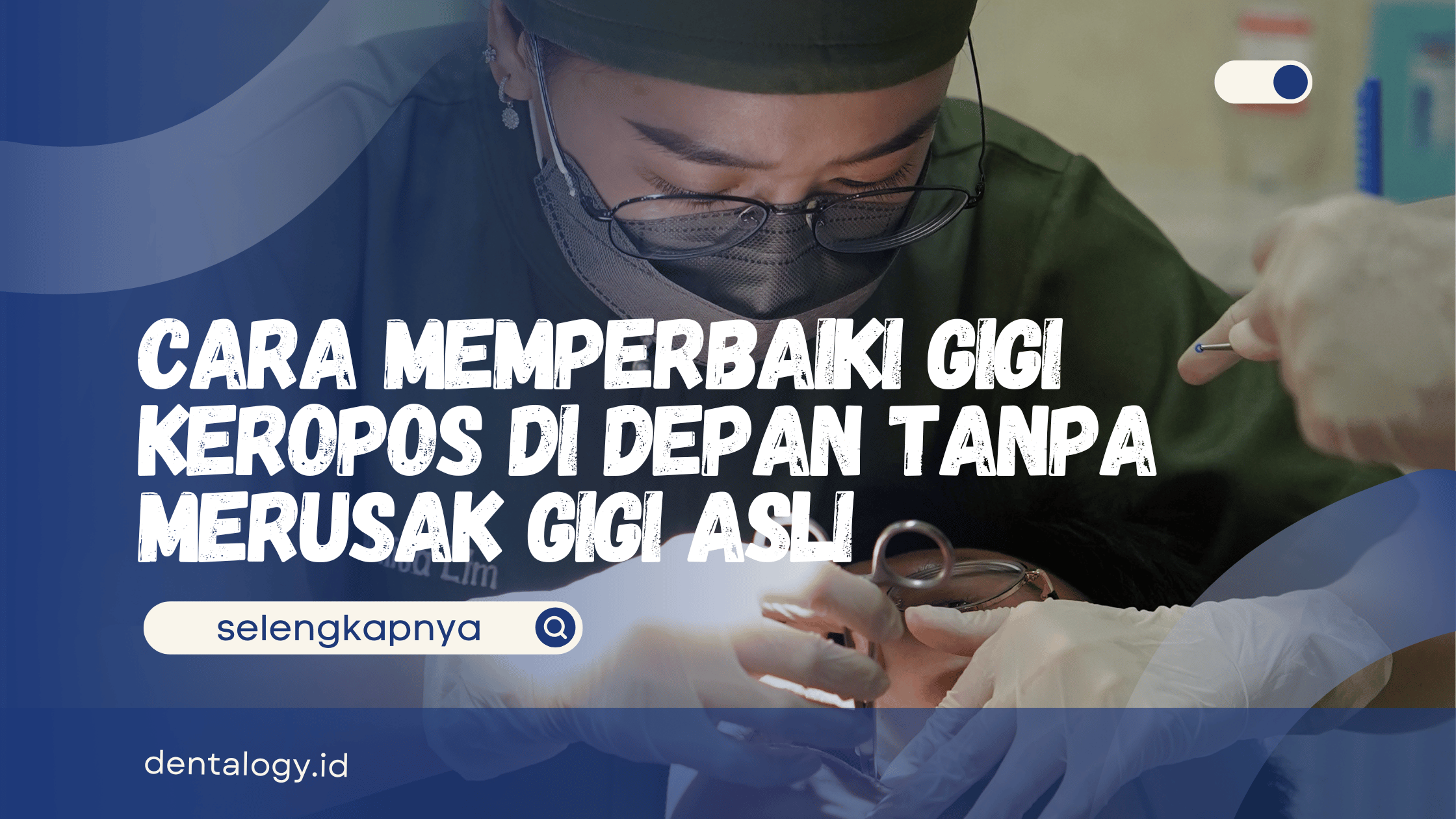 Cara Memperbaiki Gigi Keropos di Depan