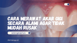 Cara Merawat Akar Gigi Secara Alami