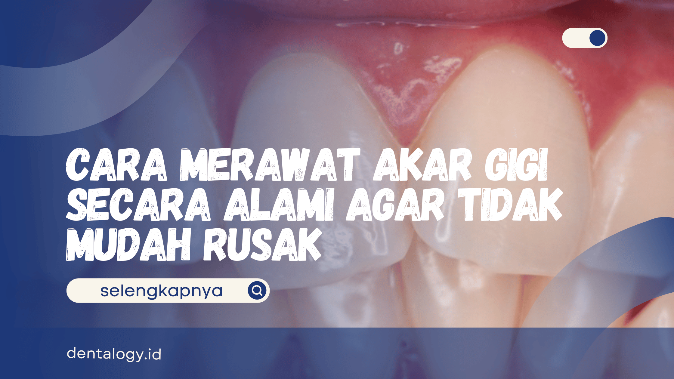 Cara Merawat Akar Gigi Secara Alami
