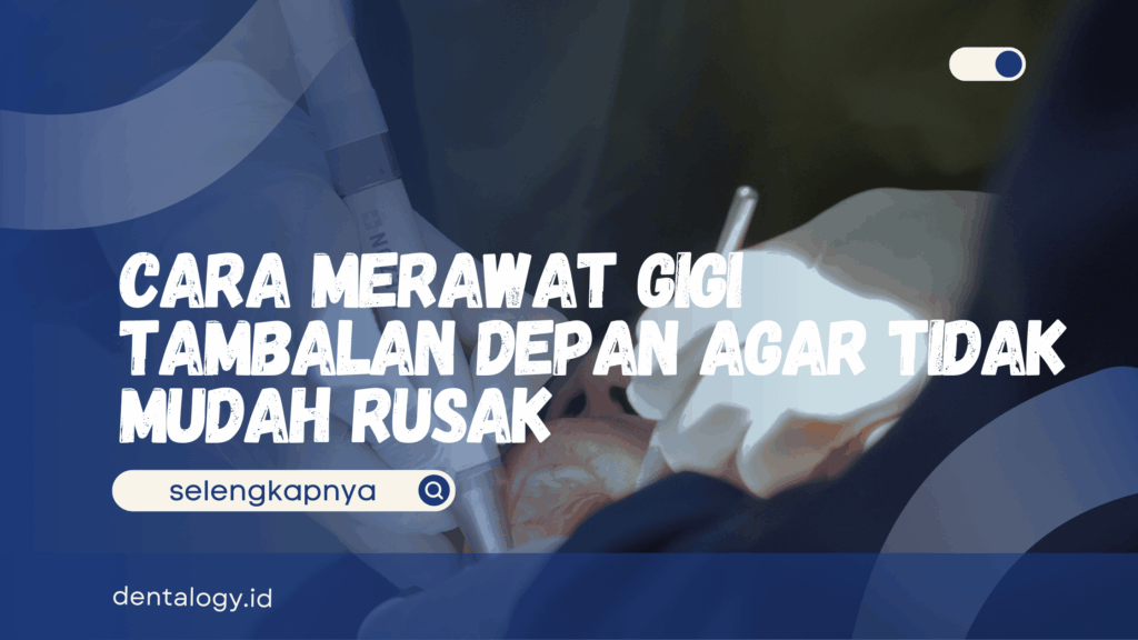 Cara Merawat Gigi Tambalan Depan