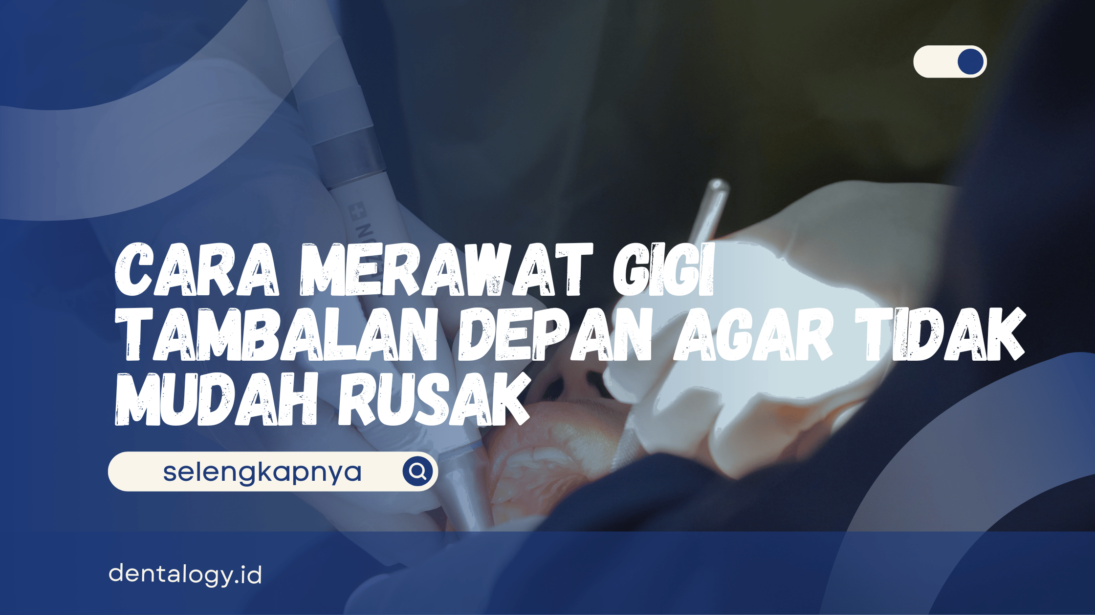 Cara Merawat Gigi Tambalan Depan