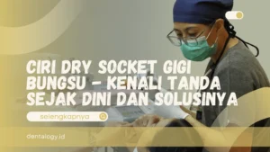 Ciri Dry Socket Gigi Bungsu