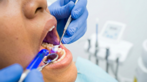 Tambal gigi surabaya