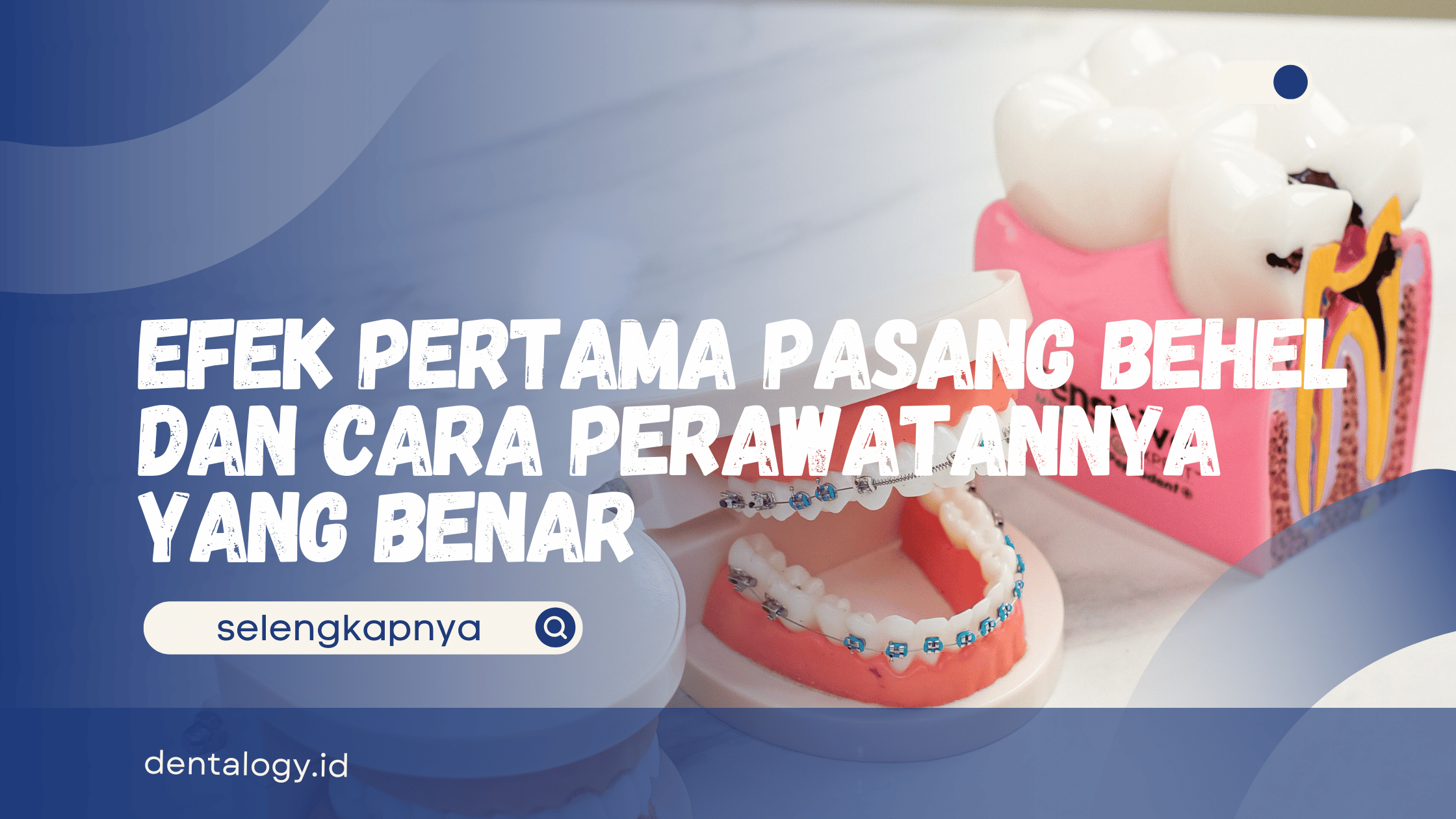 Efek Pertama Pasang Behel