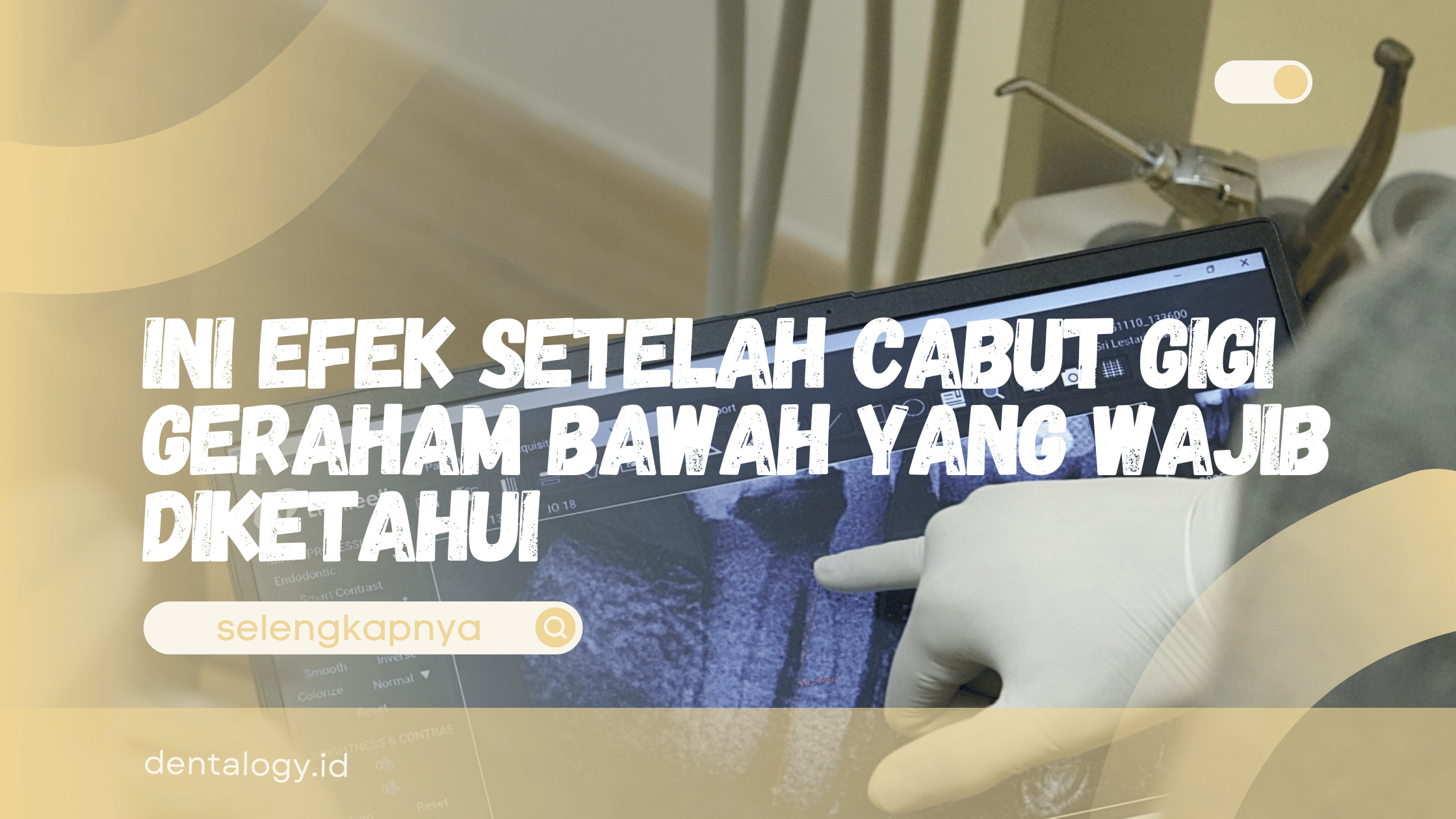 Efek Setelah Cabut Gigi Geraham Bawah