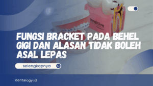 Fungsi Bracket pada Behel