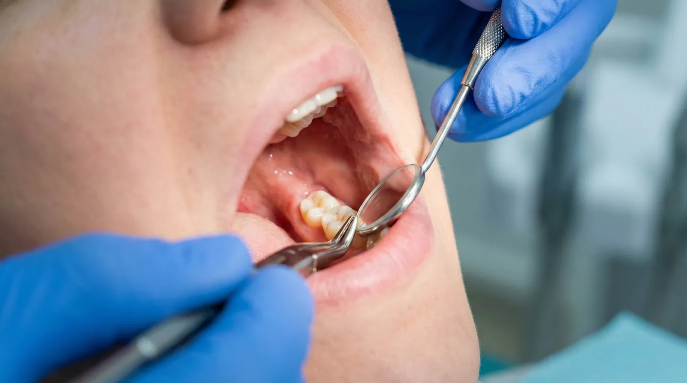 Gigi Bungsu Surabaya