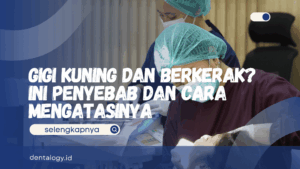 Gigi Kuning dan Berkerak