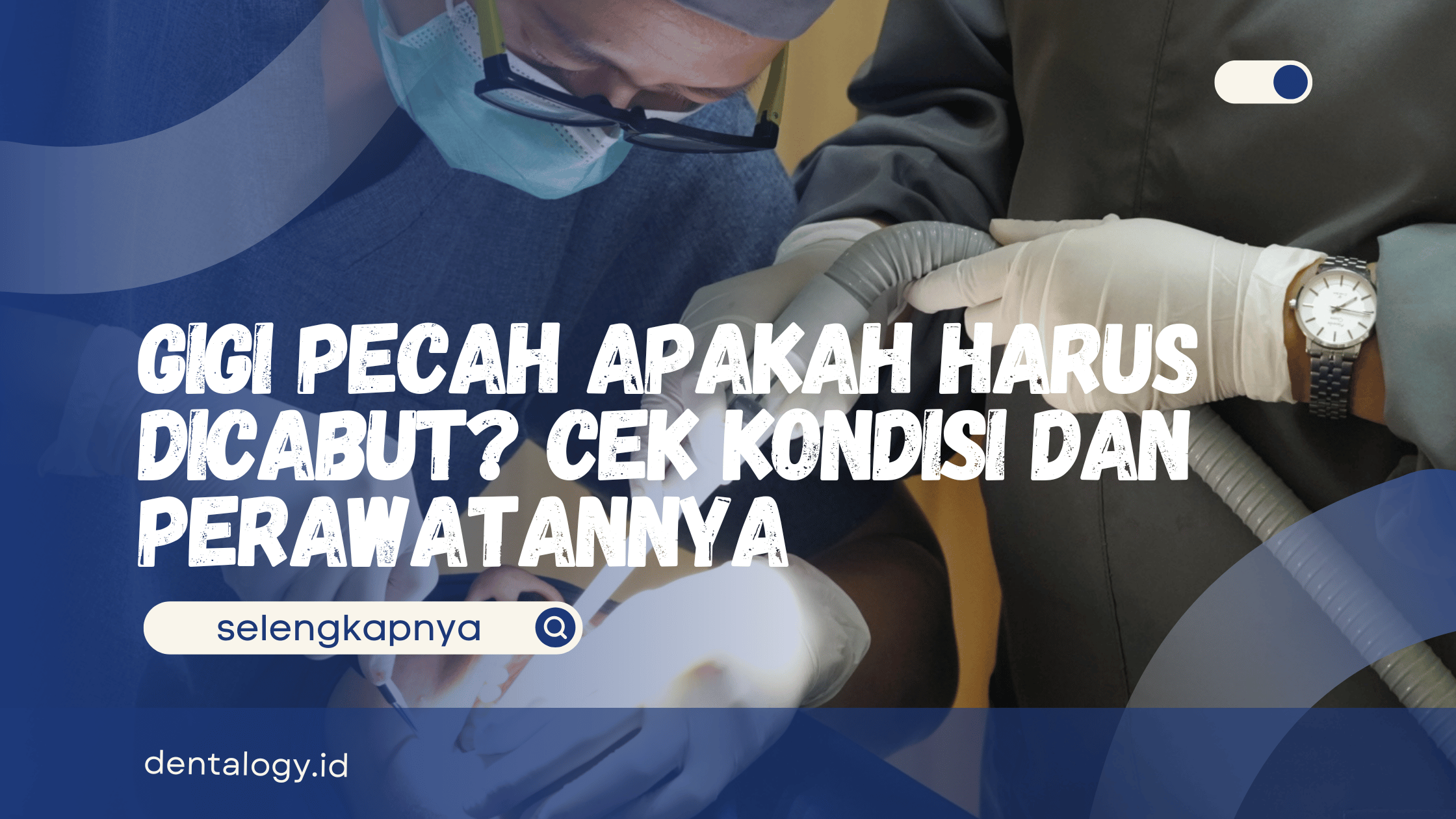 Gigi Pecah Apakah Harus Dicabut
