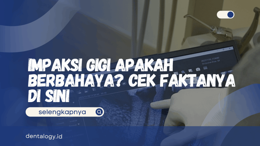 Impaksi Gigi Apakah Berbahaya