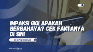 Impaksi Gigi Apakah Berbahaya