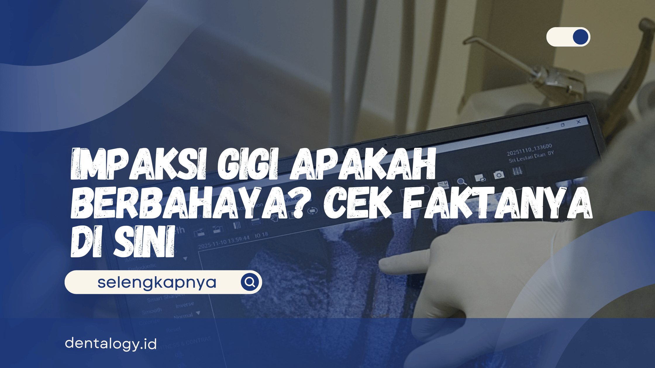 Impaksi Gigi Apakah Berbahaya