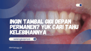 Tambal Gigi Depan Permanen