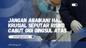Risiko Cabut Gigu Gingsul Atas
