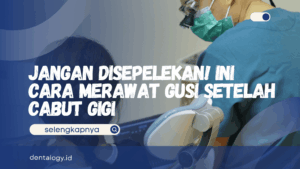 Cara Merawat Gusi Setelah Cabut Gigi