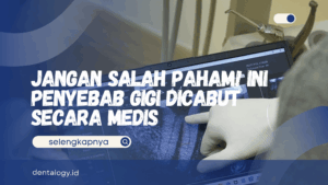 Penyebab gigi dicabut