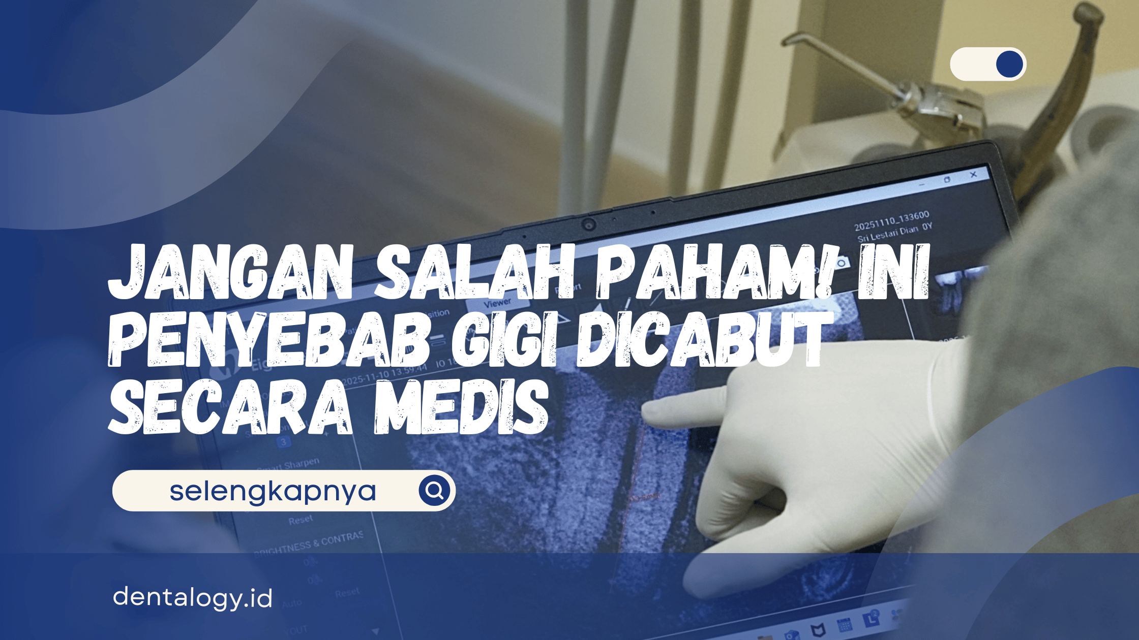 Penyebab gigi dicabut