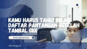 Pantangan Setelah Tambal Gigi