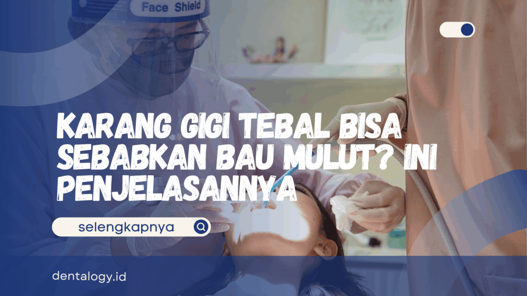 Karang Gigi Tebal