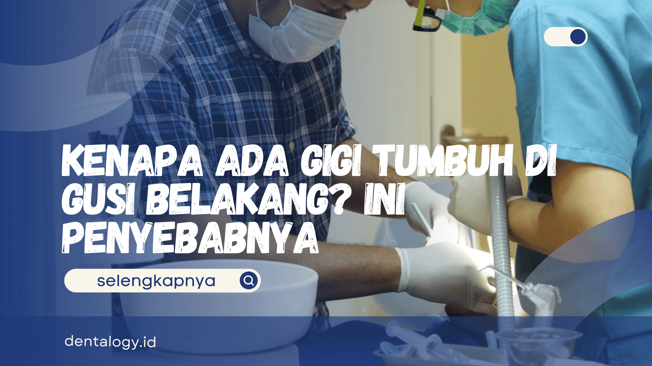 Gigi Tumbuh di Gusi Belakang