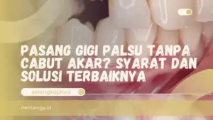 pasang gigi palsu tanpa cabut akar