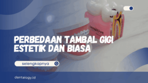 perbedaan tambal gigi estetik dan biasa
