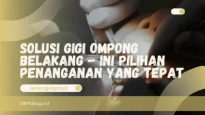 Solusi Gigi Ompong Belakang