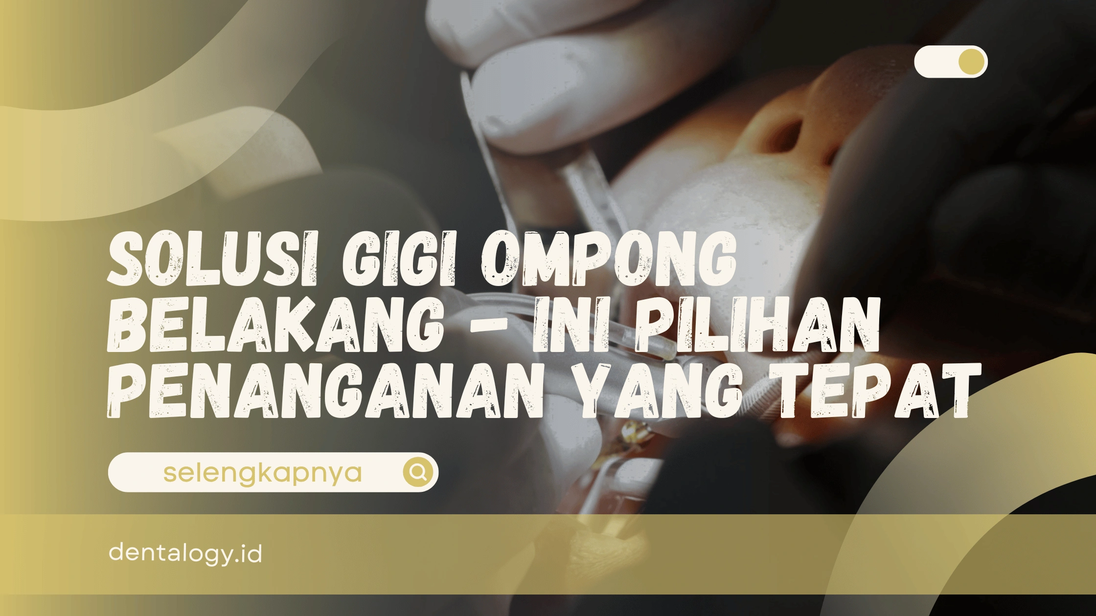 Solusi Gigi Ompong Belakang
