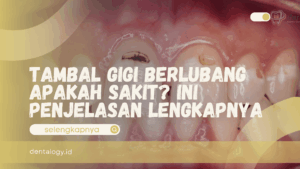 Tambal Gigi Berlubang Apakah Sakit