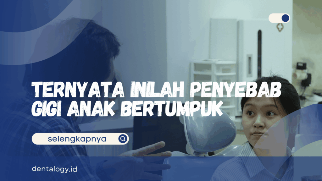 Gigi Anak Bertumpuk