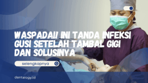 Infeksi Gusi Setelah Tambal Gigi