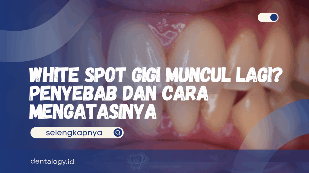 White Spot Gigi